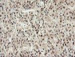 PSMB4 Antibody in Immunohistochemistry (Paraffin) (IHC (P))