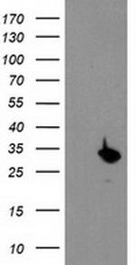 PSMB4 Antibody in Western Blot (WB)