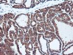 PSMB7 Antibody in Immunohistochemistry (Paraffin) (IHC (P))