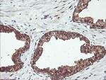 PSMB7 Antibody in Immunohistochemistry (Paraffin) (IHC (P))