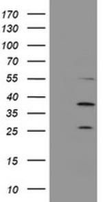 PSMB7 Antibody in Western Blot (WB)