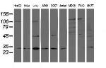PSMB7 Antibody in Western Blot (WB)