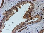 PSMB9 Antibody in Immunohistochemistry (Paraffin) (IHC (P))