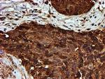 PSMB9 Antibody in Immunohistochemistry (Paraffin) (IHC (P))