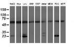 PSMB9 Antibody in Western Blot (WB)