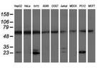PSMB9 Antibody in Western Blot (WB)