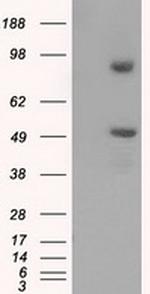PSMC3 Antibody in Western Blot (WB)