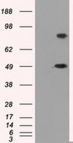 PSMC3 Antibody in Western Blot (WB)