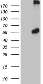 PSMC3 Antibody in Western Blot (WB)