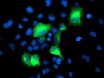 PSMD2 Antibody in Immunocytochemistry (ICC/IF)