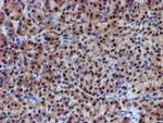 PSMD2 Antibody in Immunohistochemistry (Paraffin) (IHC (P))