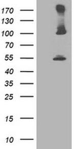 PSMD2 Antibody in Western Blot (WB)