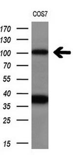 PSMD2 Antibody in Western Blot (WB)