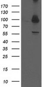 PSMD2 Antibody in Western Blot (WB)