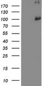 PSMD2 Antibody in Western Blot (WB)