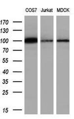 PSMD2 Antibody in Western Blot (WB)