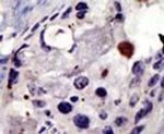 PSMD4 Antibody in Immunohistochemistry (IHC)