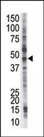 PSMD4 Antibody in Western Blot (WB)
