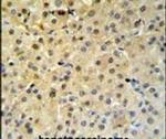 PSME1 Antibody in Immunohistochemistry (IHC)