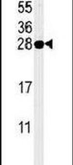 PSME1 Antibody in Western Blot (WB)