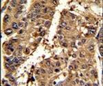 PSME2 Antibody in Immunohistochemistry (IHC)
