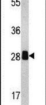 PSME2 Antibody in Western Blot (WB)