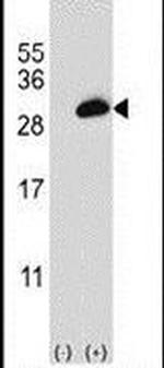 PSME2 Antibody in Western Blot (WB)