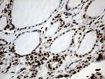 PTBP3 Antibody in Immunohistochemistry (Paraffin) (IHC (P))