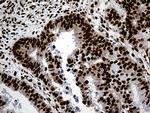 PTBP3 Antibody in Immunohistochemistry (Paraffin) (IHC (P))