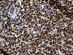 PTBP3 Antibody in Immunohistochemistry (Paraffin) (IHC (P))