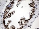 PTBP3 Antibody in Immunohistochemistry (Paraffin) (IHC (P))