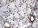 PTBP3 Antibody in Immunohistochemistry (Paraffin) (IHC (P))