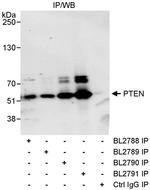 PTEN Antibody in Immunoprecipitation (IP)