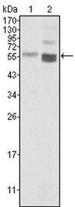 PTEN Antibody in Western Blot (WB)