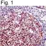 DP1 Antibody in Immunohistochemistry (IHC)
