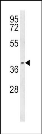PTGER3 Antibody in Western Blot (WB)