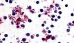 PTGIR Antibody in Immunohistochemistry (Paraffin) (IHC (P))