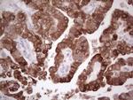 PTGS2 Antibody in Immunohistochemistry (Paraffin) (IHC (P))