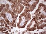 PTGS2 Antibody in Immunohistochemistry (Paraffin) (IHC (P))