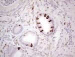 PTGS2 Antibody in Immunohistochemistry (Paraffin) (IHC (P))