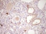 PTGS2 Antibody in Immunohistochemistry (Paraffin) (IHC (P))