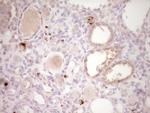 PTGS2 Antibody in Immunohistochemistry (Paraffin) (IHC (P))