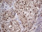 PTGS2 Antibody in Immunohistochemistry (Paraffin) (IHC (P))