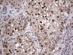 PTGS2 Antibody in Immunohistochemistry (Paraffin) (IHC (P))