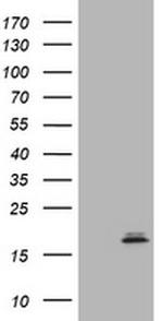 PTH Antibody in Western Blot (WB)