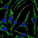 PTH1R Monoclonal Antibody (4D2)