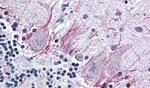 PTH2R Antibody in Immunohistochemistry (Paraffin) (IHC (P))