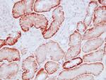 PTH1R Antibody in Immunohistochemistry (IHC)