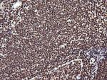 PTK2 Antibody in Immunohistochemistry (Paraffin) (IHC (P))