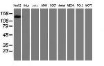 PTK7 Antibody in Western Blot (WB)